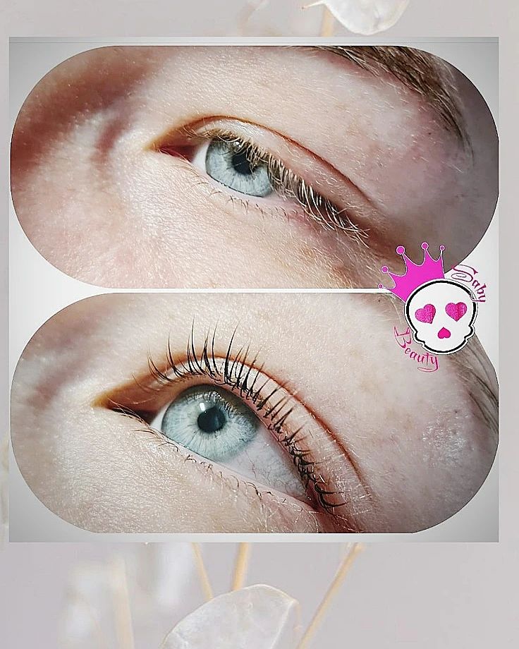 Résultats de Rehaussement de cils inZEbox 1