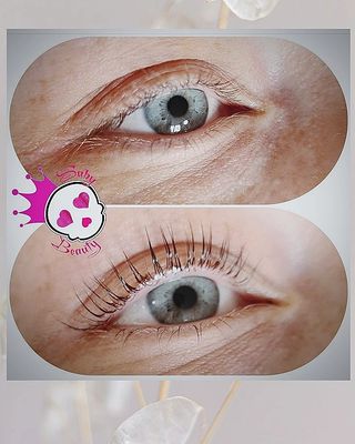 Résultats de Rehaussement de cils inZEbox 2