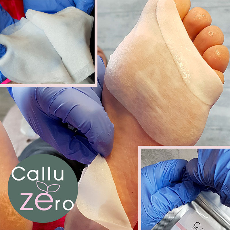 Soin des pieds calluspelling calluZEro